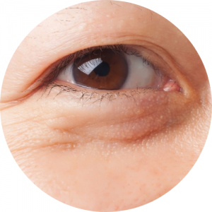 azjatyckie oko ze zmarszczkami